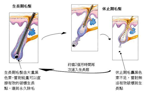 極光除毛, 冷光無感除毛, 冷光除毛 - 毛髮成長週期圖