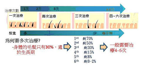 極光除毛, 冷光無感除毛, 冷光除毛 - 治療週期圖示